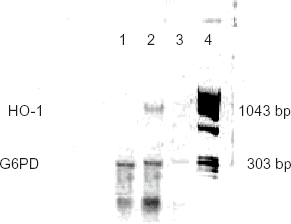 Figure 2. Hepatic HO-1 gene expressions (RT-PCR) of animals 24 h after HS resuscitation prior to sepsis induction. Lane 1: A RT-PCR product from a non-HS resuscitated animal. A 303 base-pair band represents a control gene (glyceraldehyde-6-phosphate dehydrogenase; G6PDH) expression. Lane 2: A RT-PCR product prepared from a HS resuscitated animal. A 1043 base-pair band indicates HO-1 gene expression. Lane 3: A negative control (RT-PCR done without the MuLV reverse transcriptase). Absence of bands indicates no genomic DNA contamination. Lane 4: DNA weight marker (ΦX174RF/HaeIII fragments).