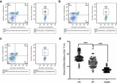 Figure 3. Expression of CD4+CXCR5+CD69+ cells in the peripheral blood (a-c) Flow cytometry-based measurement of expression of CD4+CXCR5+CD69+ cells in peripheral blood mononuclear cell (PBMCs) in the OS group (a), BT group (b), and Healthy group (c); (d) Proportion of CD4+CXCR5+CD69+ cells in CD4+ T cells. ***P < 0.001.