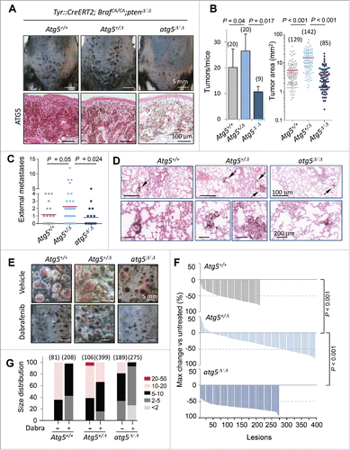 Figure 7. Impact of Atg5 copy number on melanoma initiation and metastasis in vivo (melanocyte-specific and inducible mouse models). (A) Cutaneous melanomas generated in the melanocyte-specific Tyr::CreERT2;BrafCA/CA;Ptenflox/flox; Atg5flox/flox mice, bred to maintain (Atg5+/−) or undergo mono- or bi-allelic deletion of Atg5 (Atg5+/Δ or atg5Δ/Δ, respectively). The upper photographs were captured 3 wk after systemic administration of tamoxifen. Lower panels correspond to paraffin-embedded specimens processed for the detection of ATG5 protein expression (in pink). Nuclei were counterstained with hematoxylin. Brown staining corresponds to melanin. (B) Quantification of the average tumor number and size generated in animals as in (A), represented as mean −/+ SEM. (C) Higher metastatic potential of Tyr::CreERT2;BrafCA/CA;ptenΔ/Δ;Atg5+/Δ melanomas determined by macroscopic examinations of lungs 4 wk after tamoxifen administration and represented −/+ SEM. Here as in (B), P values corresponded to paired t test. (D) Lung micrometastases at low and high magnification (upper and lower panels, respectively) in the indicated mouse genotypes visualized by virtue of melanin-expressing colonies (brown, arrows). (E) Differential response of Tyr::CreERT2;BrafCA/CA;ptenΔ/Δ melanomas to dabrafenib depending on Atg5 copy number. Images correspond to representative lesions in the depilated back skin of the indicated animal groups, 4 wk after tamoxifen induction, and 3 wk of dabrafenib treatment (10 mg/kg orally, once a day). (F) Response rates measured as the reduction in tumor size vs averaged untreated controls of the Tyr::CreERT2;BrafCA/CA;ptenΔ/Δ driven melanomas of Atg5+/−, Atg5+/Δ or Atg5Δ/Δ backgrounds, represented as waterfall plots. (G) Size distribution (mm2) of control and dabrafenib-treated cutaneous lesions of the indicated genotypes.