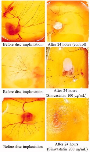 Figure 8. The results of CAM assay after treatment with two doses of simvastatin (100 and 200 µg/mL). In simvastatin treatment groups, dissolved blood vasculature showed its antiangiogenic effect. While ethanolic discs containing control group showed intact blood vessels network.