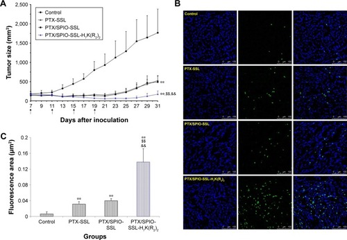 Figure 5 In vivo antitumor activity of PTX/SPIO-SSL-H7K(R2)2.Notes: BALB/C nude mice were inoculated s.c. with MDA-MB-231 cells and treated with 5% glucose solution, PTX-SSL (15 mg/kg, i.v., q4d), PTX/SPIO-SSL (15 mg/kg, i.v., q4d), and PTX/SPIO-SSL-H7K(R2)2 (15 mg/kg, i.v., q4d), respectively. For each administration, formulations were given to mice via the tail vein. (A) Tumor growth inhibition. (B) TUNEL staining of the tumor tissue sections was performed according to the standard protocols provided by the manufacturers. The apoptotic cells were detected by TUNEL. DNA strand breaks were labeled green, and the nuclei were stained with Hoechst 332589 (blue). Apoptotic cells exhibited a turquoise color as a result of color merging of these two labels. (C) The fluorescence area of each group was used for the statistical analysis of apoptosis activity. **p<0.01 versus the 5% glucose solution treatment group as a control; $$p<0.01 versus the PTX-SSL treatment group; &&p<0.01 versus the PTX/SPIO-SSL treatment group.Abbreviations: i.v., intravenous; PTX, paclitaxel; PTX/SPIO-SSL, PTX/SPIO-loaded liposome; PTX/SPIO-SSL-H7K(R2)2, H7K(R2)2-modified liposome containing PTX and SPIO; PTX-SSL, sterically stabilized liposome containing PTX; q4d, twice a day for 4 days; s.c., subcutaneously; SPIO, superparamagnetic iron oxide; TUNEL, terminal deoxynucleotidyl transferase dUTP nick end labeling.