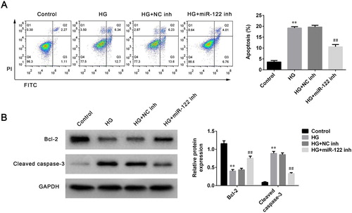 Figure 2. miR-122 knockdown suppressed cell apoptosis of high glucose-induced ARPE-19 cells (A) Flow cytometry was used to determine apoptosis of ARPE-19 cells treated with high glucose and transfected with the miR-122 inhibitor (B) Western blot was performed to measure the levels of Bcl-2 and cleaved caspase-3 in ARPE-19 cells treated with high glucose and transfected with the miR-122 inhibitor. **: p < 0.01. ##: p < 0.01.