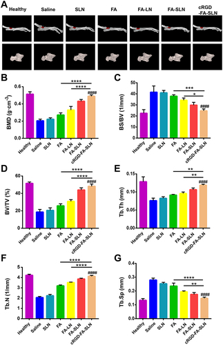 Figure 11 Micro-computed tomography detection of ankle joints. (A) Three-dimensional micro-computed tomography images of ankle joint bones. (B–G) Effect of different treatments on (B) bone mineral density (BMD), (C) ratio of bone surface area to bone volume (BS/BV), (D) ratio of bone volume to tissue volume (BV/TV), (E) trabecular thickness (Tb.Th), (F) trabecular number (Tb.N), (G) and trabecular spacing (Tb.Sp). Data are shown as mean ± SD (n = 5). ####P < 0.0001 vs saline; *P < 0.05, **P < 0.01, ***P < 0.001, ****P < 0.0001.
