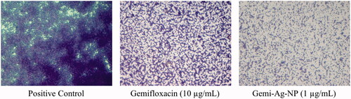Figure 11. Light microscopic evaluation of MRSA after treatment with Gemi-AgNPs and Gemifloxacin.