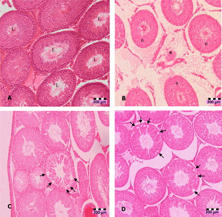 Figure 1. Photomicrographs of testis sections of DZN-treated animals (1 week), (A) normal seminiferous tubules (L indicates lumen) in untreated animals, (B) shrinkage (*) of seminiferous tubules in 10 mg/kg b.w. DZN-treated group, (C) halo appearance or vacuoles (arrows) in the seminiferous tubules of 15 mg/kg b.w. DZN-treated group, and (D) more vacuoles (arrows) in the seminiferous tubules of 30 mg/kg b.w. DZN-treated group. Vacuoles were also observed in 2 weeks of DZN exposure – 10, 15, and 30 mg/kg groups. Slides were stained with haematoxylin-eosin dye. Scale, 200 µm.
