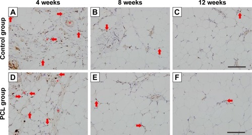 Figure 6 Ki67-stained section of the samples at different time points.Notes: In both groups, most Ki67-positive cells (arrowhead) were located near blood vessels (star) at week 4 (A, D) and the number decreased at week 8 (B, E). Almost no Ki67-positive cells could be found at week 12 (C, F). Scale bar =200 μm.Abbreviation: PCL, polycaprolactone.