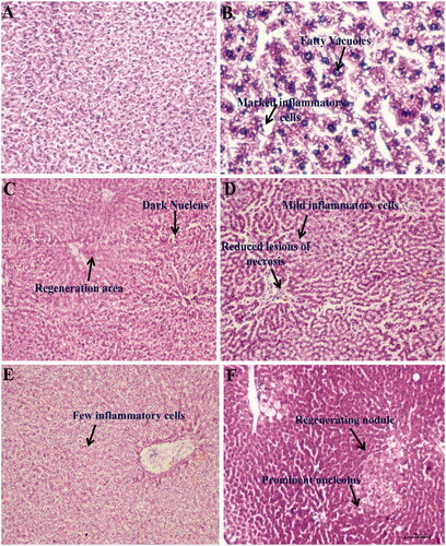 Figure 7. Representation of histopathological changes in livers obtained from rat groups at (H&E, ×100) (A) Normal control; (B) CCl4 control; (C) silymarin 50 mg/kg treated; (D) β-aescin 0.9 mg/kg treated; (E) β-aescin 1.8 mg/kg treated; (F) β-aescin 3.6 mg/kg treated.