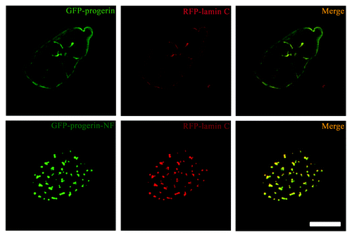 Figure 3. Expression of non-farnesylated progerin alters the nuclear distribution of lamin C in transiently transfected MEFs. Confocal fluorescence micrographs showing localizations of GFP-progerin and GFP-progerin-NF (green signals) with RFP-lamin C (red signals) in the same cells; merged images are shown at the right with signal overlap appearing yellow (merge). Bar: 5 µm.