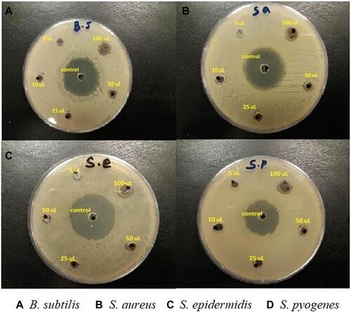 Figure 8 Micrograph showing the diameter of zone of inhibition [mm] due to AME-AgNPs exposure to four Gram positive microbial pathogens. (A) B. subtilis, (B) S. aureus, (C) S. epidermidis and (D) S. pyogenes.