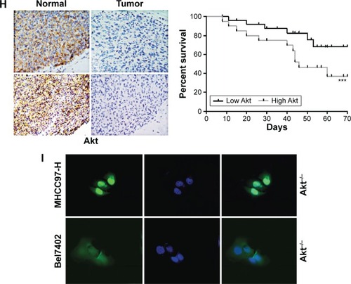 Figure 1 The expression of Akt in different cells.Notes: (A) Western blot analysis of Akt; (B) Akt mRNA levels in normal liver cells and liver cancer cell lines; (C) Akt protein levels in normal liver cells and liver cancer cell lines; (D) Akt mRNA levels after treatment of Akt-knockout in MHCC97-H cells; (E) Akt mRNA levels after treatment of Akt-knockout in Bel7402 cells; (F) Akt protein levels after treatment of Akt-knockout in MHCC97-H cells; (G) Akt protein levels after treatment of Akt-knockout in Bel7402 cells; (H) immunohistochemical staining of normal liver cells and tumor cells using Akt-specific antibodies shows higher survival percent at low Akt levels (100×); (I) IF analysis of NC group and liver cancer cell lines: DAPI (blue), Akt (Green). Data are expressed as the mean ± standard error of the mean, *P<0.05, **P<0.01, ***P<0.001 versus Nor (control group).Abbreviations: Nor, normal liver cells; Nor, normal; NC, negative control; DAPI, 4′,6-diamidino-2-phenylindole; IF, immunofluoresence.
