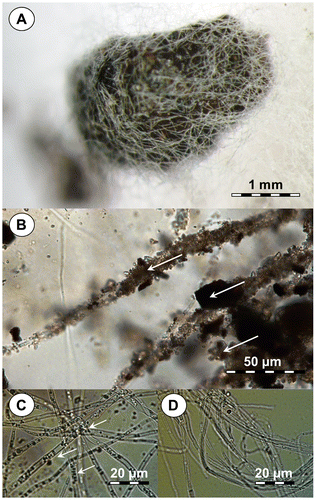 Fig. 4. Light micrographs of N. fischeri strain ECCN 84 cultured as a lawn on agar containing basal salts medium illustrating attachment to coal particles.Notes: (A) Typical mycelial pellet or sclerotia-like structure formed after addition of sterile powdered waste coal; (B) attachment of hyphae to coal particles within the mycelial pellet or sclerotia-like structures; (C) high-resolution image showing the presence of peroxisome-like organelles in hyphae from cultures supplied waste coal; and (D) hyphae from cultures in the absence of waste coal substrate lacking peroxisome-like organelles.