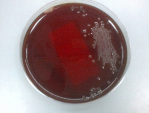 Figure 1 The translucent droplet colonies of Campylobacter fetus, as seen on Skirrow’s media.