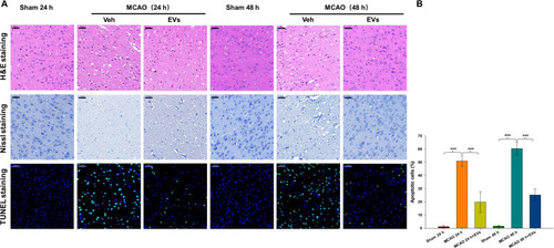 Figure 4 Effects of MSCs-EVs on MCAO-induced neuronal pathological changes. (A) Representative HE, Nissl and TUNEL staining in the cortex following MCAO insult. (B) MSCs-EVs effectively reduced apoptosis in cerebral cells after MCAO (scale bar=50 μm). The data are expressed as the mean ± SD (n = 3). ***p < 0.001 by ANOVA with Bonferroni test for post hoc comparisons.