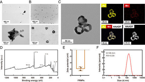 Figure 1 Characterization of FRNPs. (A and B) TEM images of GNCs and FRNPs at different magnifications. (C) The HRTEM and elemental mappings of FRNPs, yellow represents Au and red represents Mn. Scale bar: 50 nm. (D) XPS spectrum of FRNPs. (E) Zeta potential of FRNPs. (F) Dynamic light scattering (DLS) analysis of FRNPs.