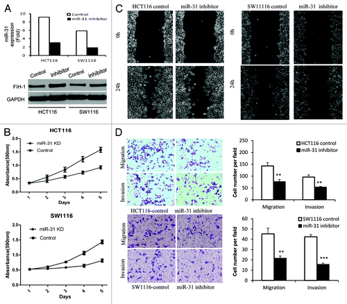 Figure 3. Effect of miR-31/FIH-1 nexus on proliferation, migration, invasion of HCT116 and SW1116 cells. (A) The transfection efficiency of anti-miR-31 siRNA and the promotion of FIH-1 expression in HCT116 and SW1116 cells. (B) Inhibition of miR-31 (promotion of FIH-1 expression) had significant effect on decreasing proliferation rate of both cell lines. (C) Wound closure was delayed in cells transfected with anti-miR-31 siRNA as compared with negative control in 24 h time points in both types of CRC cells. (D) Representative fields of invasion (down) or migration (up) cells on the membrane was on the left (magnification of 200×). Average invasion or migration cell number per field was on the right. The invasion or migration cell number of HCT116 and SW1116 transfected with anti-miR-31 siRNA was drastically decreased than that transfected with pairing negative control. **P < 0.01, ***P < 0.001.