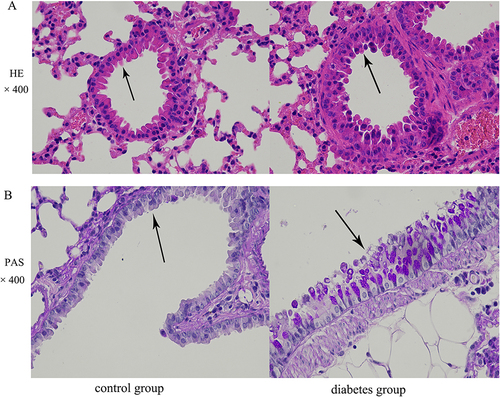 Figure 2 The morphological structure of airway epithelium is altered in the db/db murine model of diabetes mellitus. Airway epithelia in lungs of control and diabetic mice were stained with (A) HE (black arrows indicate the tracheal wall, original magnification, ×400) and (B) PAS (black arrows indicate goblet cell metaplasia in the airway epithelium, original magnification, ×400).