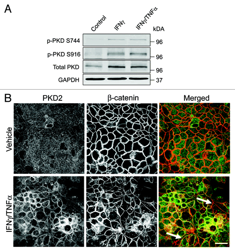 Figure 6. Cytokines trigger upregulation and membrane translocation of protein kinase D. (A) Representative immunoblots demonstrate an increase in the amounts of phosphorylated (p) protein kinase D (PKD) species in HPAF-II lysates after 24 h exposure to either IFNγ alone or IFNγ plus TNFα. (B) Dual fluorescence immunolabeling of PKD2 (green) and β-Catenin (red) shows a diffuse apical staining of PKD2 in control HPAF-II cells and accumulation of this enzyme at the areas of E-cadherin-based cell-cell contact after 24 h of the IFNγ/TNFα treatment (arrows). Bar, 20 μm.