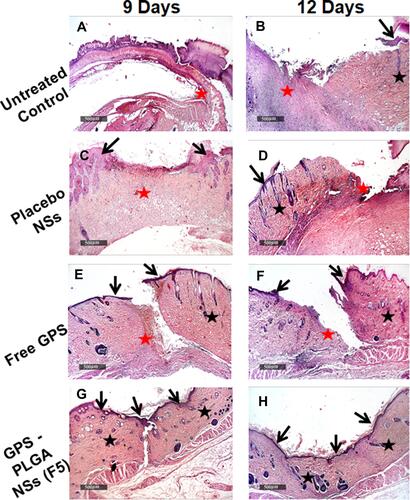 Figure 13 Wound healing process at day 9 and day 12-time interval in different groups. (A and B) Untreated Control, (C and D) Placebo NSs, (E and F) Free GPS, and (G and H) GPS - PLGA NSs (F5). H&E stain 40X. Arrow = Epidermal layer. Black star = Dermal layer, Red star = wound gab granulation tissue.