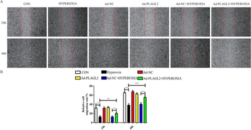 Figure 2. Upregulation of PLAGL2 can restore the migration ability of AECII cells inhibited by hyperoxia. (A)Representative images of wound healing assay for ACEII cells at 24 and 48 h. Red lines indicate the leading edge of the migrating cells (magnification × 40). (B)Migration of ACEII cells was tested and the distance of the wound was calculated up to 48 h. Compared with CON group. *p < 0. 05, **p < 0. 01, ***p < 0. 001 was considered statistically significant.