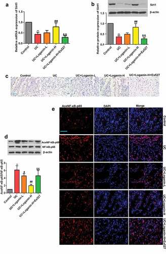 Figure 5. Effects of loganin on the activation of Sirt1/NF-κB signaling pathway in colon tissues of UC mice. (a) The mRNA expression levels of Sirt1. (b) The protein expression levels of Sirt1. (c) Representative immunohistochemistry pictures of Sirt1 protein, scale bar = 50 μm. (d) Levels of acetylated NF-κB-p65 were determined by western blot assay. (e) Levels of acetylated NF-κB-p65 were determined by immunofluorescence assay, scale bar = 50 μm. Data were presented as means ± SD. ** p < 0.01 compared with control group; # p < 0.05, ## p < 0.01 compared with UC group; && p < 0.01 compared with UC + Loganin-H group.