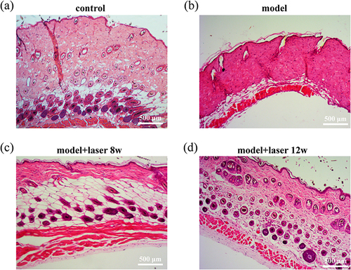 Figure 4 Histological analysis of mouse skin tissues following various treatments using H-E staining. (a)control (b)model (c)model+laser 8w (d)model+laser 12w.