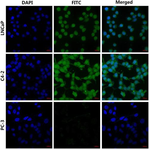 Figure 2 Binding ability of the PSMA-binding peptides to the cells Blue fluorescence represents the nuclei of the three types of prostate cancer cells, and green fluorescence represents the PSMA-binding peptides. The PSMA-binding peptides could specifically bind to PSMA-positive LNCaP cells and C4-2 cells but not to PSMA-negative PC-3 cells.