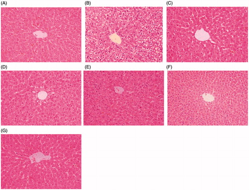 Figure 4. Photomicrographs of HE-stained liver sections. Tissues were divided into 3-mm sections and stained with hematoxylin and eosin for light microscopic analysis. The photomicrographs are of livers obtained from (A) Control group, (B) TP group, (C) MIG + TP group, (D) RIF + TP group (E) LLE + TP group, (F) MLE + TP group, (G) HLE + TP group.