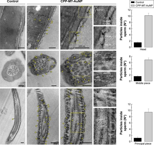 Figure 5 Internalized CPP-MT-AuNP complexes can be found in various human sperm intracellular structures.Notes: Sperm were incubated with 20 µg/mL CPP-MT-AuNP or BSA-coated AuNP (control) for 3 hours. Samples were fixed and processed for electron microscopy as described in section “Materials and methods”. Left: TEM image gallery showing representative AuNPs localization for each experimental condition. Right: the number of incorporated AuNPs was quantified for each sperm region (head, middle, and principal pieces). Scale bars =200 nm. The data represent mean values ± SEM, calculated from four independent experiments with at least 100 cells analyzed. One-way ANOVA shows statistically significant difference between particles inside sperm incubated with CPP-MT-AuNP vs the control group for all the samples analyzed, P<0.0001 (Dunnett’s t-test).Abbreviations: AuNP, gold nanoparticles; CPP, cell-penetrating peptide; MT, metallothionein; CPP-MT-AuNP, CPP-MT protein-conjugated AuNP; BSA, bovine serum albumin; TEM, transmission electron microscopy.