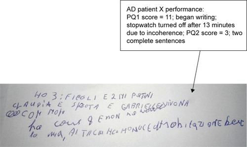 Figure 1 The performance of AD patient X and DLB patient X during PQ1, followed by the letter-writing test, followed by PQ2.