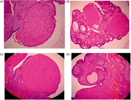 Figure 2. Histological changes in the ovary: (A) normal rat ovary; (B) cystic ovary after PCOS induction; (C) ovary treated with quercetin, nearly normal; (D) metformin-treated ovary close to normal.
