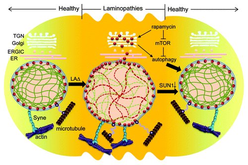 Figure 1. The cause and reversal of laminopathies. In normal cell, SUN1 (red dots) is located in the inner nuclear membrane and interacts with the nucleoskeleton (via nuclear lamin A) and the cytoskeletal actin (via Syne1 and Syne2) and microtubules in supporting nuclear integrity. Loss of functional lamin A (LAΔ, either Lmna−/− or LmnaΔ9) is reported to result in accumulated SUN1 in the NE and Golgi (through anterograde transport), leading to nuclear morphology aberrations and cellular senescence. The removal of over accumulated SUN1 by genetic deletion or RNA silencing ameliorates nuclear aberrancies and prolongs longevity in mice. An alternative route to reversing the cellular phenotype of progeria is through activating autophagy using rapamycin. Rapamycin inhibits mTOR, activates autophagy, and thereby enhances the degradation of progerin (LAΔ50) in HGPS cells. The removal of abnormally accumulated progerin, as well as other protein moieties, is postulated to abolish nuclear blebbing and alleviate the onset of cellular senescence. ERGIC, ER-Golgi-intermediate compartment; TGN, trans-Golgi network; Syne, synaptic nuclear envelope; mTOR, mammalian target of rapamycin.