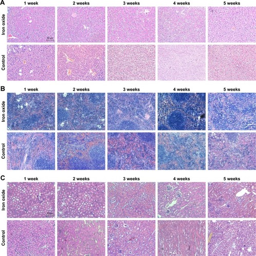 Figure 4 Toxicity assessment of DATS-MIONs via H&E staining in vital organs.Note: Evaluation in (A) liver, (B) spleen, and (C) kidneys.Abbreviations: DATS, diallyl trisulfide; MIONs, mesoporous iron oxide nanoparticles.