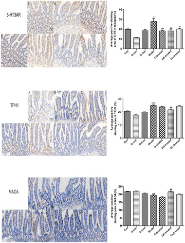 Figure 10 TPH-1, MAO-A, and 5-HT3 receptor immunostaining in ileum.