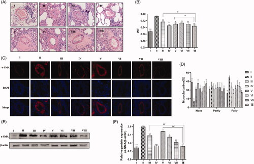 Figure 7. Effects of SIL and XMA administered separately or in combination on pulmonary arterial remodelling in rats with MCT-induced PH rats. (A) HE staining showing representative micrographs of pulmonary artery remodelling. (B) Quantitative analysis of the percentage of medial arteriole thickness. (C) A representative image of the immunohistochemical staining for alpha smooth muscle actin (α-SMA) antibody. (D) The proportion of muscularized small pulmonary arteries. (E, F) The expression of α-SMA were analyzed by western blotting and the protein expression ratio of α-SMA to β-actin was evaluated. Group I:control group received saline; Group II: MCT group received MCT(60 mg/kg); Group III: SIL-Low group received MCT + SIL at 10 mg/kg/day; Group IV: SIL-high group received MCT + SIL at 30 mg/kg/day; Group V: XMA-High group received MCT + XMA at 62.9 mg/kg/day; Group VI: SIL(Low) +XMA (Low) group received SIL(10 mg/kg) + XMA at 125.8 mg/kg/day; Group VII: SIL(Low)+XMA(Medium) group received SIL(10 mg/kg) + XMA at 251.6 mg/kg/day; Group VIII: SIL(Low)+XMA(High) group received SIL(10 mg/kg) + XMA at 251.6 mg/kg/day. Data are presented as the mean ± SEM. (n = 6–8). *p < 0.05, **p < 0.01 vs. Group II; #p < 0.05, ##p < 0.01 vs. Group VIII.