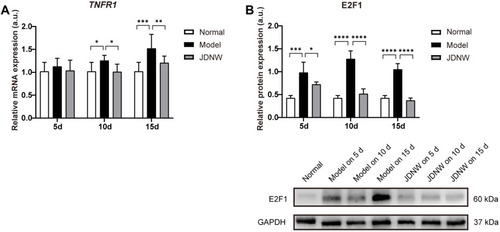 Figure 4 The JDNW formula inhibited the expression of TNFR1 and E2F1 in ACLF rats.