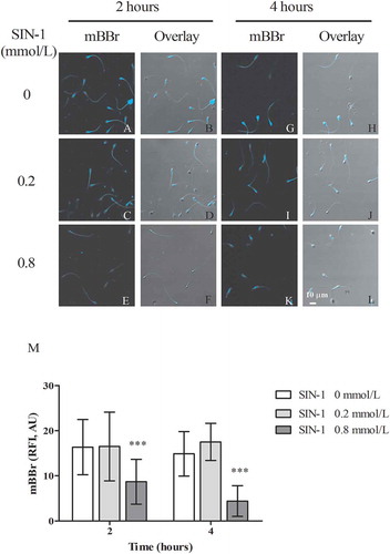 Figure 3. Effect of peroxynitrite on thiol group. Human spermatozoa were exposed for 2 and 4 hours at 0 (A, B, G, and H), 0.2 (C, D, I and J), and 0.8 (E, F, K, and L) mmol/L of SIN-1. Left column inside panels showed mBBr fluorescence sperm pictures due to thiol groups and right columns correspond to the overlay with phase contrast (PhC). (M) Representative images from one experiment. The relative fluorescence intensity (RFI-AU, see text for explanation) of mBBr was tabulated at 2 and 4 hours, under 0 (untreated control), 0.2, and 0.8 mmol/L of SIN-1. Values represent the mean ± SD. (***) p ˂ 0.05 compared to the untreated control in the same incubation time. SIN-1: 3-morpholinosydnonimine; mBBr: monobromobimane.