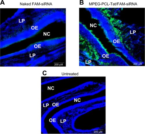 Figure 4 Distribution of FAM-siRNA in slices of nasal mucosa after intranasal administration of naked FAM-siRNA and MPEG-PCL-Tat/FAM-siRNA.