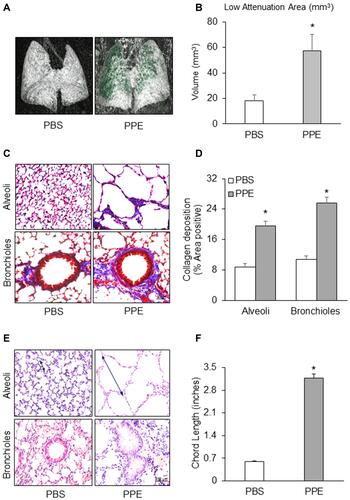 Figure 1 Histopathological and morphological changes in the lung of mice receiving porcine pancreatic elastase (PPE) or phosphate buffered saline (PBS) instillation. (A) Representative micro-computed tomography (micro-CT) lung images. (B) Bar graph shows the low attenuation area (LAA) of the lung (n=4). (C) Representative photomicrographs depicts Masson’s trichrome staining of lung tissue. (D) Summarized data showing collagen deposition in blue color detected by Masson’s trichrome staining (n=3). (E) Hematoxylin and Eosin staining of the lung tissue. (F) Summarized bar graphs shows PPE significantly increased alveolar sacs and spaces in the lung. (n=6). *P<0.05 vs PBS treatment.