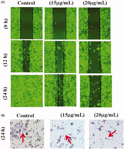 Figure 10. Effect of AuNPs from A. spectabilis on cell migration in T24 cell lines.
