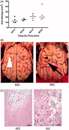 Figure 9. (A) Higher temperature and longer hyperthermia duration resulted in increased area of cerebral damage, measured from gross sectioned tissue in acute animals. (B) There is a defect in both brains, but to a lesser extent in animal exposed to 45 °C (tip of white arrow head). In animals exposed to 50 °C, there is a gross cavity within cerebral parenchyma and an associated expansion of the dura mater (black arrow). (C) Histology damage assessment. Both images are at 100× magnification and represent the ventral aspect of the probe insertion site. There is less damage to the surrounding parenchyma in the dog exposed to 45 °C (left) compared to 50 °C (right). Animals exposed to 50 °C had increased hemorrhage, vacuolization (clear spaces), and inflammatory response. Scale bar is 100 μm.
