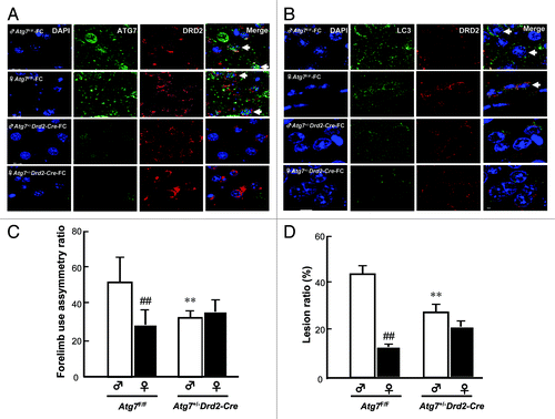 Figure 6.Atg7 conditional knockout in DRD2 neurons abolished the sex difference in FC-induced CN injury. Knockout of Atg7 decreased the ATG7 immunoreactivity (A) and LC3 aggregation (B) in DRD2 neurons in both male and female mice. The brain tissues containing the CN from male or female mice with (Atg7+/–D rd2-Cre) or without (Atg7F/F) Atg7 conditional knockout were sampled 2 d after FC infusion and sectioned at 10 μm thickness. ATG7 antibody or LC3 antibody followed by a secondary antibody conjugated to FITC and DRD2 antibody followed by a second antibody conjugated to rhodamine were used to stain for ATG7 or LC3 (green) and DRD2 neurons (red), respectively. Simultaneously, nuclei were stained with DAPI. The nuclei surrounded by cytosolic ATG7 or LC3 in DRD2 neuron depict ATG7-containing or autophagic DRD2 neurons as indicated using arrows. (C) Knockout of Atg7 significantly decreased the FC-induced behavioral deficit in male mice and diminished the sex difference in FC-induced behavioral deficit. Forelimb use asymmetry ratio depicting an index of behavioral deficit. (D) Knockout of Atg7 significantly decreased the level of FC-induced striatal injury in male mice and diminished the sex difference in FC-induced striatal lesion ratio. Data are expressed as means ± SD (n = 6). *p < 0.05, **p < 0.01 compared with the sham control sex-matched group. ##p < 0.01 compared with the male sham.