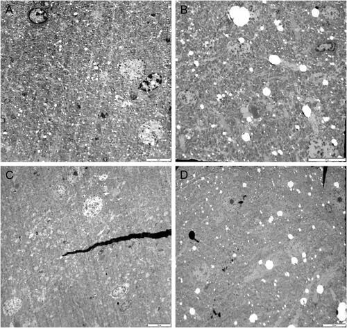 Figure 9. Representative TEM images of the left brain temporal cortex. Sham control group (A), 900 MHz exposure group (B), 1800 MHz exposure group (C), 2100 MHz exposure group (D). Scale bars = A:5 µm (A); 10 µm (B, C, D).