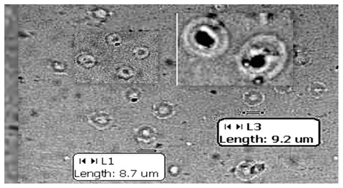 Figure 1 Optical photomicrograph of MLVs under 40× magnification.Abbreviation: MLV, multi lamellar vesicles.