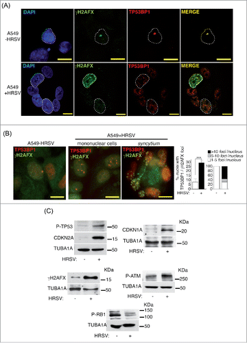 Figure 2. HRSV induces DNA damage. (A) Analysis of confocal colocalization of the DNA damage markers γH2AFX and TP53BP1 in HRSV-infected A549 cells (48 h.p.i. MOI = 3). Magnification: 600X; scale bar: 10 μm (B) Conventional indirect immunofluorescence showing the presence of γH2AFX and TP53BP1 in mock and infected A549 cells (48 h.p.i. MOI = 3). Magnification: 600X; scale bar: 10 μm. Quantification of the DNA damage foci containing γH2AFX and TP53BP1 is shown at the right panel. (C) Detection by western-blotting of various DNA damage and proliferation arrest markers in mock and infected A549 cells (30 h.p.i. MOI = 3: panels P-TP53, CDKN2A, P-RB1, P-ATM); 48 h.p.i. MOI = 3: panels CDKN1A and γH2FAX. KDa: kilodaltons. Bars in the graphs represent the mean ± SD of 2 experiments, n = 3 replicates. DNA damage foci were counted from >150 cells for each experimental condition. Data from panel c are of a representative experiment.