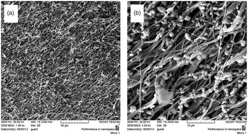 Figure 1. SEM photographs from Bio-Oss®-coated polycaprolactone nanofibrous scaffolds fabricated using electrospinning at two magnifications (1.00 kx (a), 5.00 kx (b)).