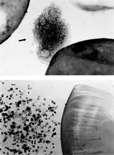 Figure 5. (a) Group IV (hepatocytes and bone marrow cells co-encapsulation by two-step method). At week 6, the recovered microcapsules were disrupted mechanically to release the content. The hepatocytes released were in an aggregated form. (b) After using Trypsin–EDTA, the aggregated cells in recovered microcapsules were dispersed and the hepatocyte viability could be determined.