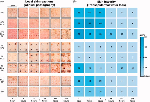 Figure 4. Local skin reactions and skin integrity measurements. A: Local skin reactions are shown using clinical photography. Laser-channel grids can be seen in the first block, covering the laser-based interventions. The second block shows black dots marking the papule endpoint spots for the NI interventions. The third block shows topical BLM and electroporation controls for the laser and NI interventions. A grid of needle entry points can be seen on all EP-based interventions. B: Skin integrity heatmap based on transepidermal water loss (g/m2/h). AFL: ablative fractional laser; BLM: bleomycin; EP: electroporation; NI: needle injection; SAL: saline.