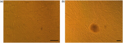 Figure 1. Morphological changes of cultured cells in tissue culture plates. (a) hiPSCs in DMEM (control group). (b) hiPSCs in IPC differentiation media at day 21. Scale bars are 100 µm.