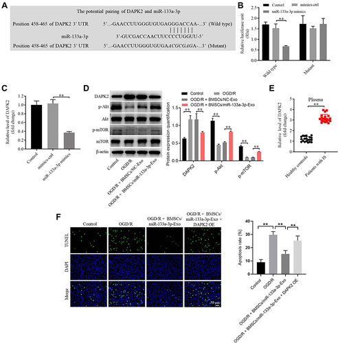 Figure 4 MiR-133a-3p directly targeted DAPK2. (A) Targetscan was used to predict the downstream mRNA of miR-133a-3p. (B) The relative luciferase activity in WT/MT-DAPK2 was detected by dual luciferase assay. (C) SH-SY5Y cells were transfected with mimics-ctrl or miR-133a-3p mimics. The levels of DAPK2 in SH-SY5Y cells were tested by RT-qPCR. (D) SH-SY5Y cells were treated with OGD/R, OGD/R + BMSCs/NC-Exo or OGD/R + BMSCs/miR-133a-3p-Exo. The protein levels of DAPK2, Akt, p-Akt, mTOR and p-mTOR in SH-SY5Y cells were investigated by Western blot. (E) The level of DAPK2 in plasma of patients with IS and healthy people was tested by RT-qPCR. (F) SH-SY5Y cells were treated with OGD/R, OGD/R + BMSCs/miR-133a-3p-Exo or OGD/R + BMSCs/miR-133a-3p-Exo + DAPK2 OE. The apoptosis of SH-SY5Y cells was tested by TUNEL staining. **P< 0.01.