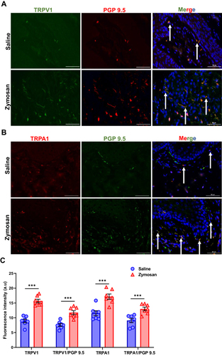 Figure 6 TRPV1 and TRPA1 expression in vulvar nerves after 160 days of the 3rd round of zymosan/saline administration. (A) The expression of TRPV1 channel in vulva nerves, 20 days after the 3rd zymosan/saline administration. Coexpression of TRPV1 channel (green) and neuronal PGP 9.5 (red; White arrows) merged with dapi stain (blue). (B) The expression of TRPA1 channel in vulva nerves, 20 days after the 3rd round zymosan\saline administration. Coexpression of TRPA1 channel (red) and neuronal PGP 9.5 (green; White arrows) merged with dapi stain (blue). Scale bar: 50 µm. (C) Fluorescence intensity (arbitrary units) of TRPV1, TRPA1, TRPV1/PGP-9.5, and TRPA1/PGP-9.5 in the zymosan and the saline groups 160 days of the 3rd round (n=8 per group). Mean ± SEM. ***P<0.001.